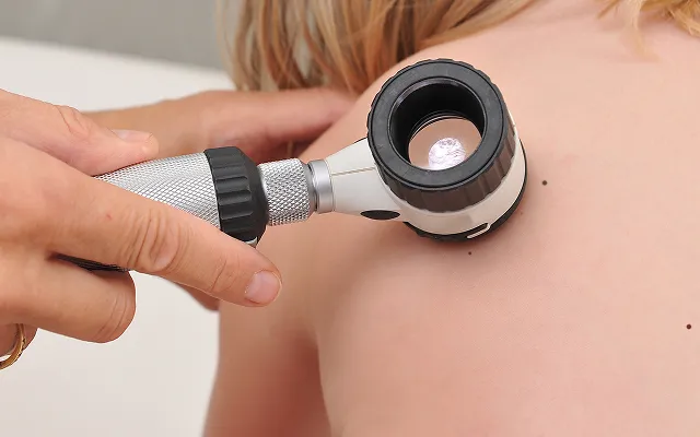 Untersuchung eines Hautflecks mit einem Dermatoskop