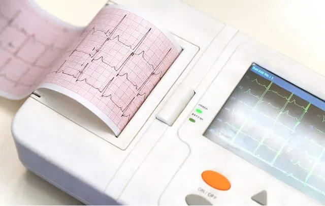 EKG-Gerät mit aufgezeichneter Herzaktivität